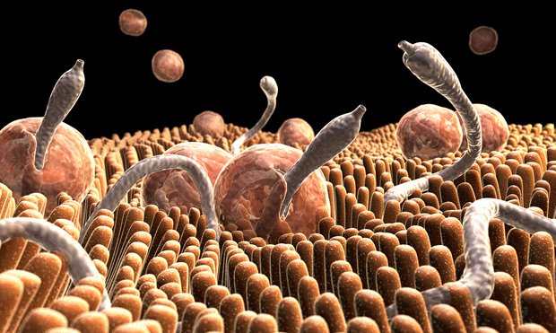 Parasites (worm-like) inside the body
